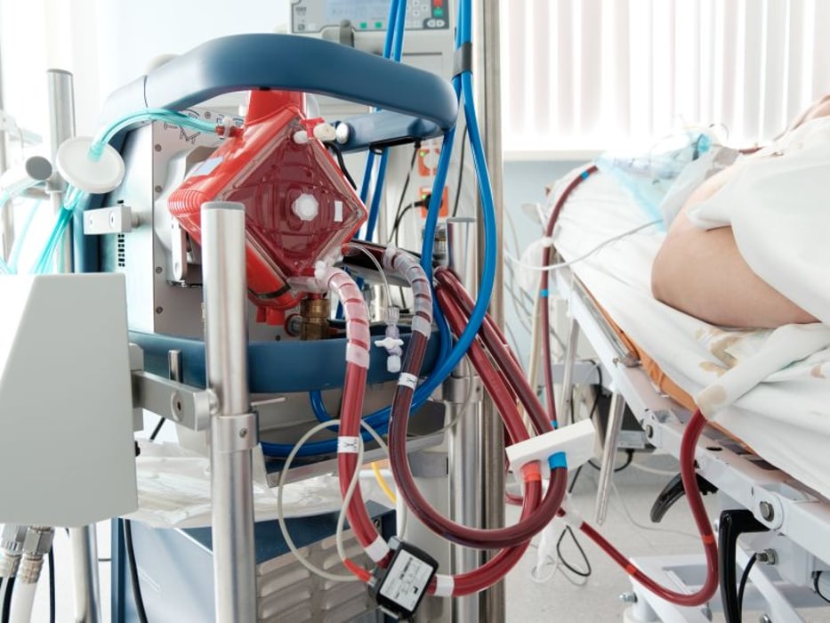 ECMO at work in an ICU