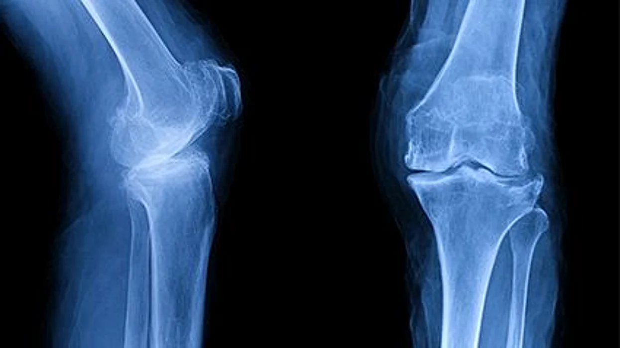 x-ray image