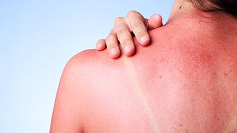 Even Winter Carries Skin Cancer Risks for College Students