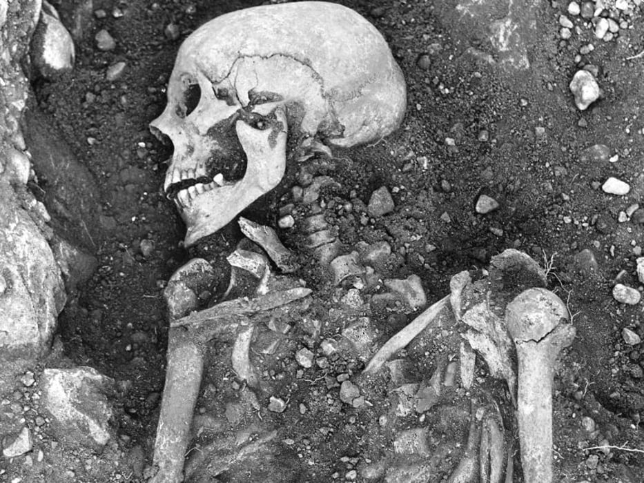 1,200-year old Viking skeleton with signs of smallpox