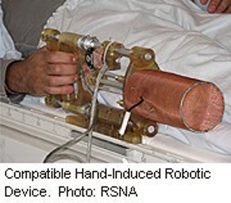 Un dispositivo robótico podría ayudar a los pacientes de accidente cerebrovascular