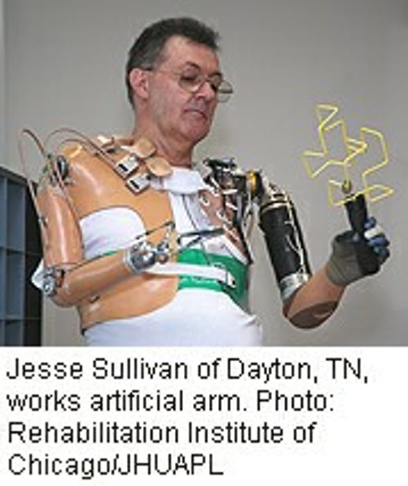 New Technology May Boost Artificial Arms