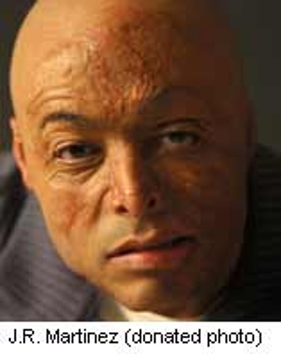 Iraq War Vet, Daytime TV Star Turns Scars Into Inspiration