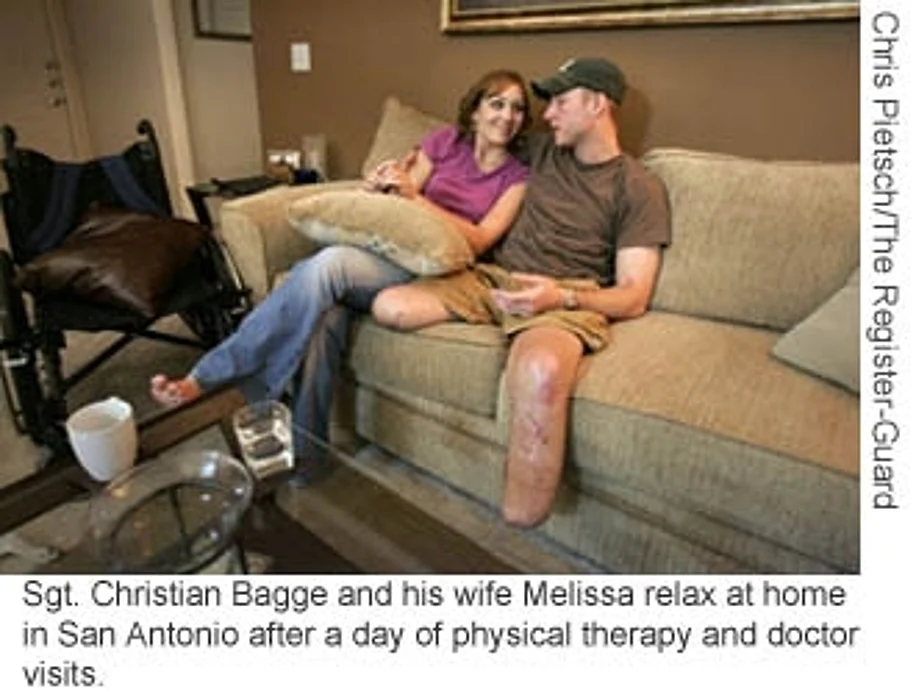 Phantom Limb Pain