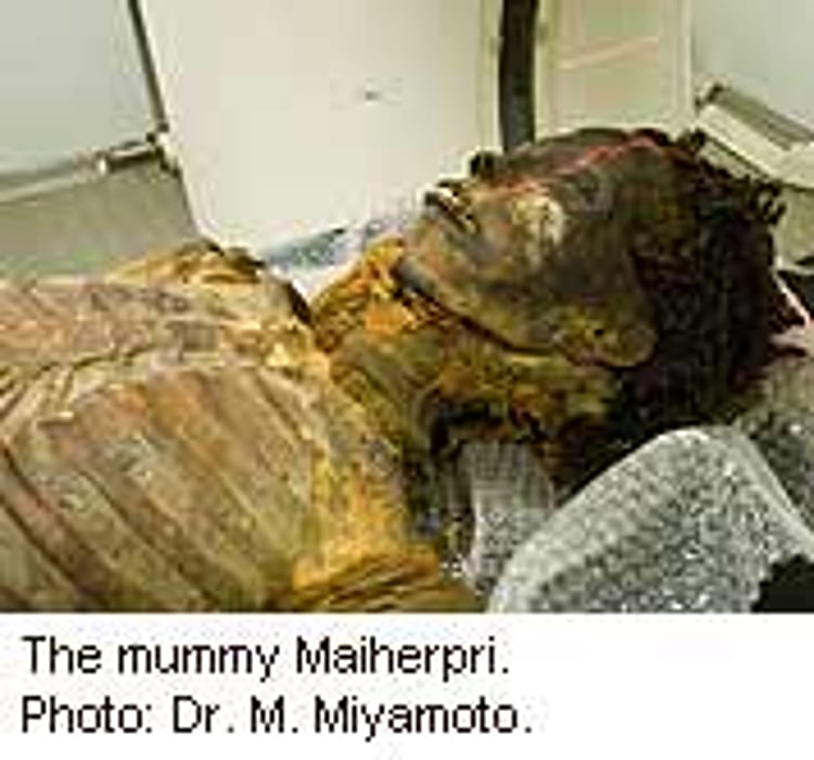 Mummies Show Heart Disease Is an Ancient Problem