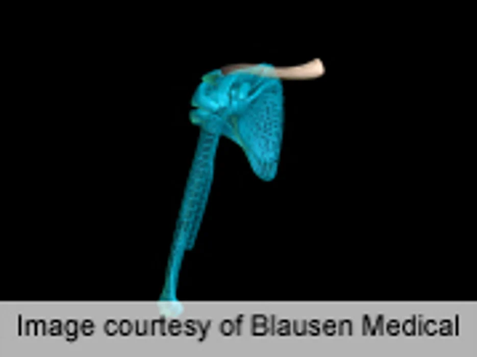 Few Retears After Partial-, Full-Thickness Rotator Cuff Repair