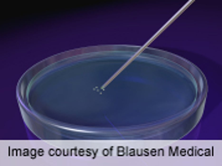 Engineered Cartilage Feasible for Nasal Reconstruction
