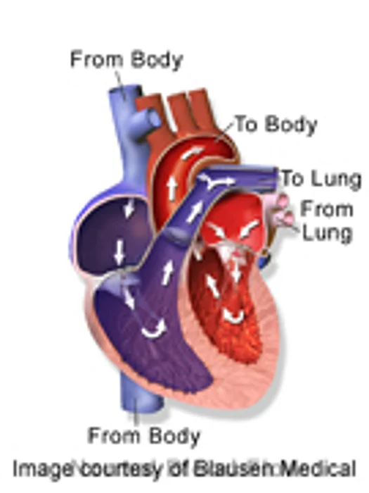 Study Finds Link Between Heart Failure, Brain Changes