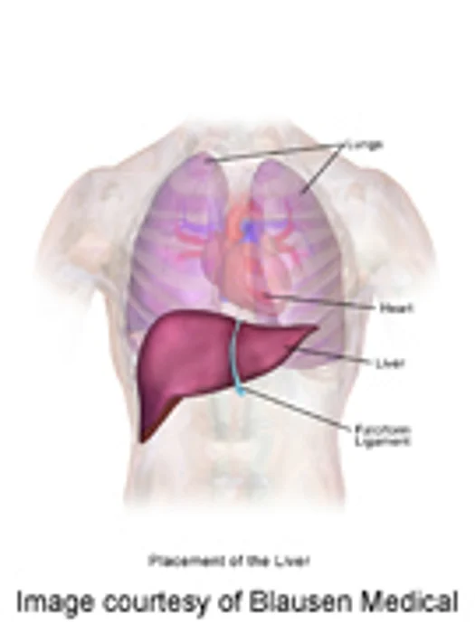 'Excellent' Survival Seen for Liver Transplant From Live Donor