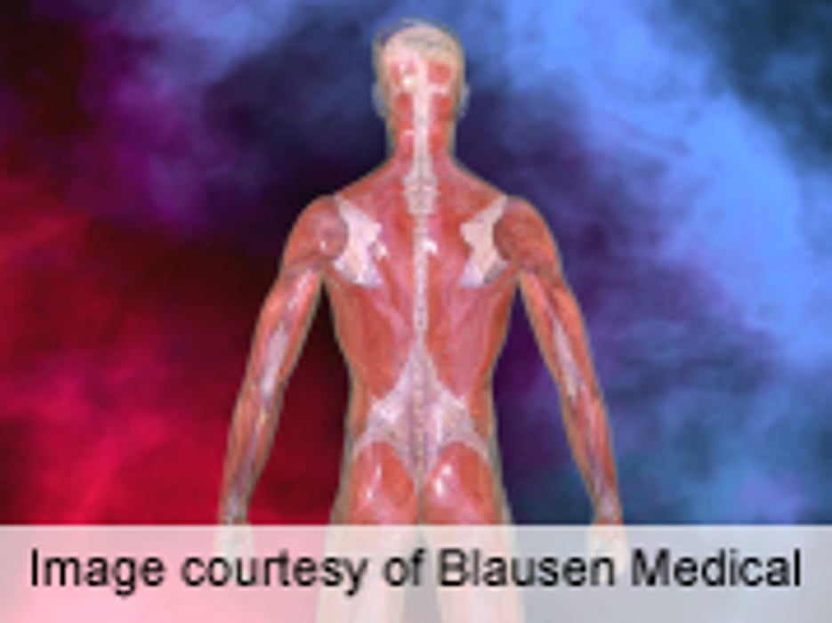 Muscle-Related Statin Effects Seem to Correlate With Potency