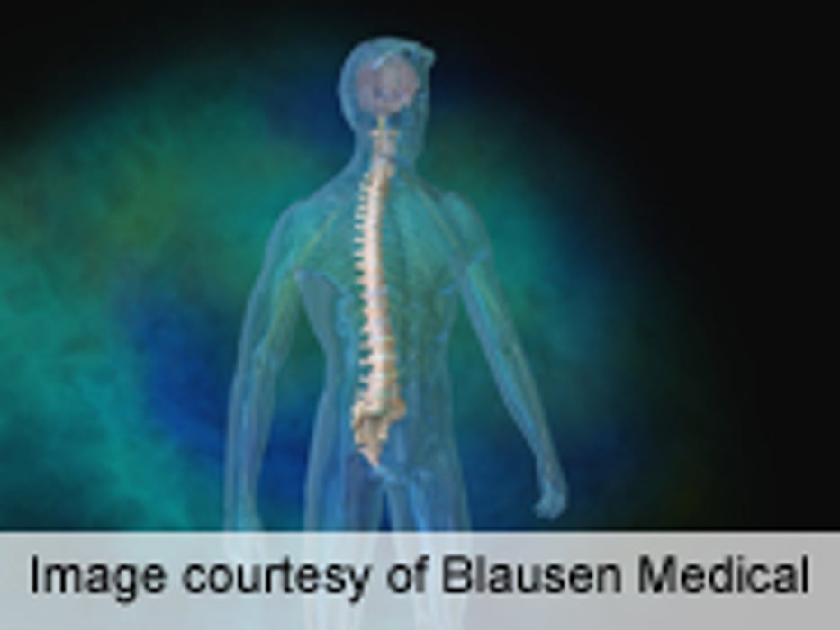 Variety of Techniques Effective for Treating Spinal Synovial Cysts