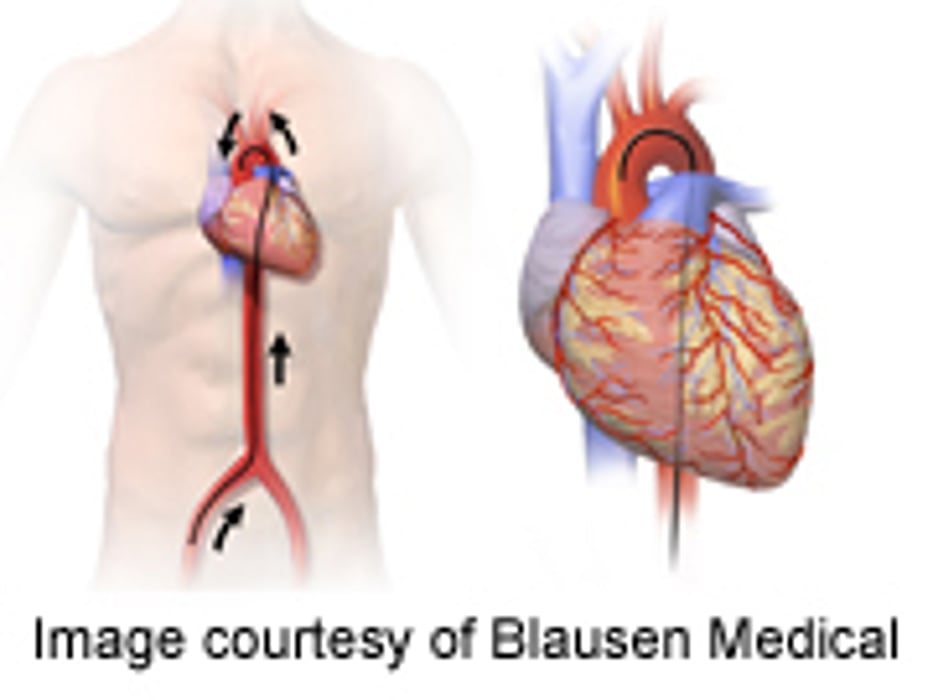 Aspirin, Warfarin Fare Equally for Heart Failure Patients