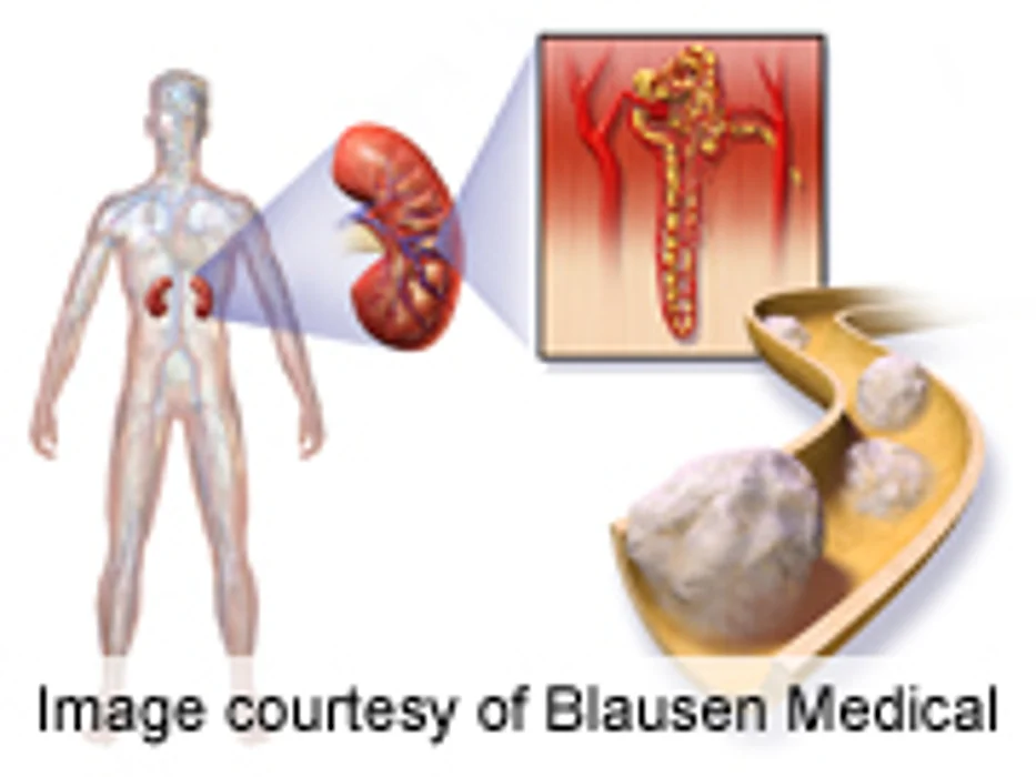 Certain Cancer Drugs May Have Fatal Side Effects: Analysis