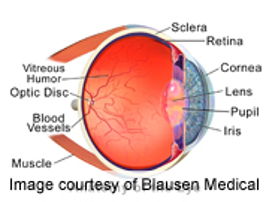 More Success With Gene Therapy for Blindness