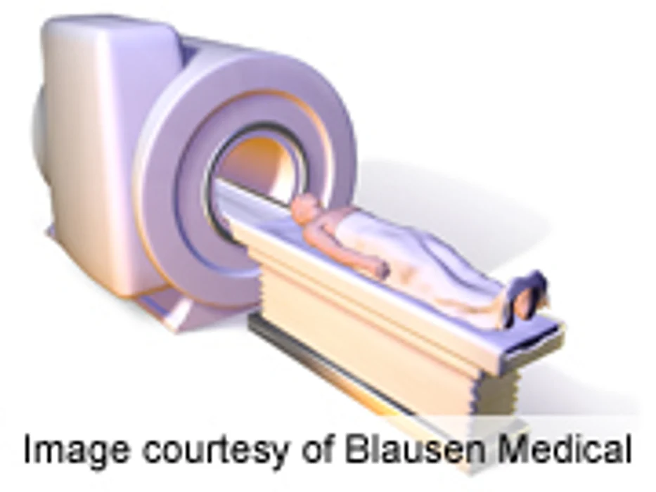 MRI Scanners Temporarily Impair Neurocognitive Function
