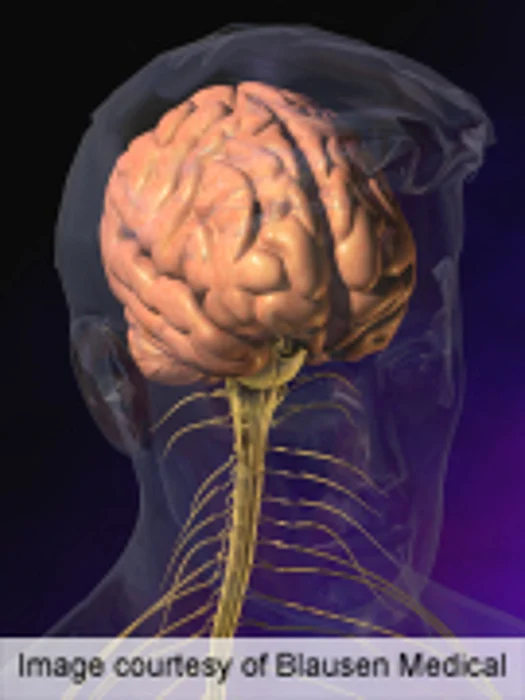 Glucose Intolerance Not Linked to Alzheimer's Pathology