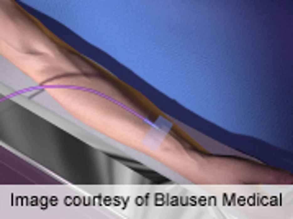 Cancer Patients May Be Unintended Victims of Budget Cuts