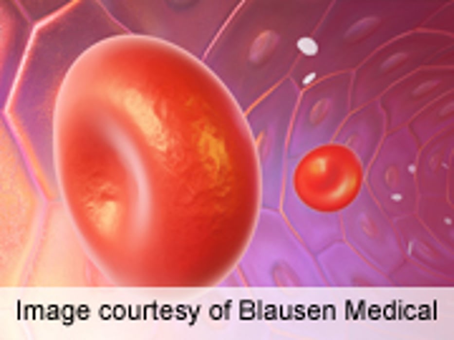 Pre-Op Eltrombopag Reduces Need for Platelet Transfusions