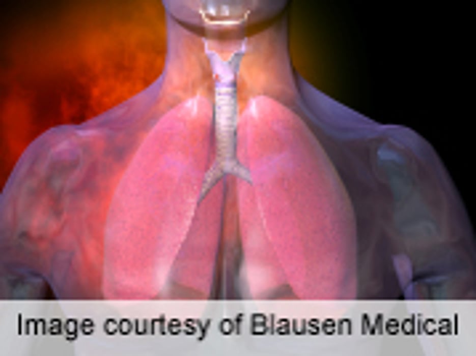 Occupation Implicated in 16 Percent of Adult Asthma in U.K.