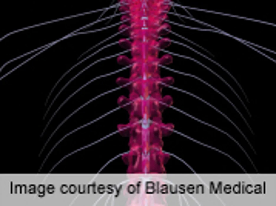New Kind of Therapy Shows Early Promise in MS Patients