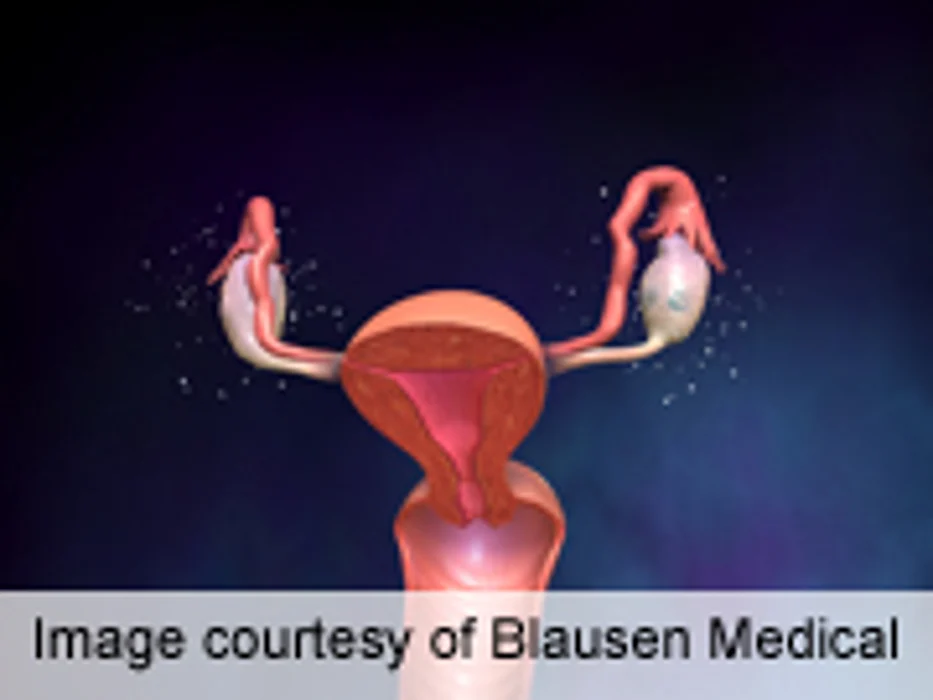 Evidence Indicates Link for Shift Work, Ovarian Cancer