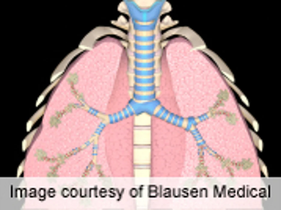 Barriers to Asthma Care for Low-Income High Cost-Sharing