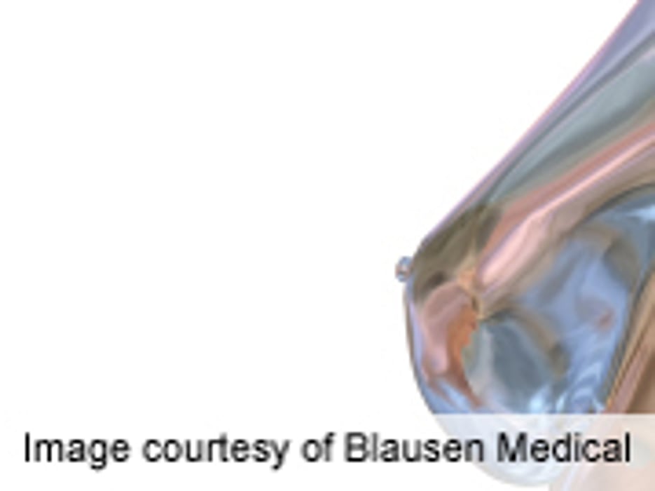 Addition of Tomosynthesis to Mammography Cuts Recall Rate