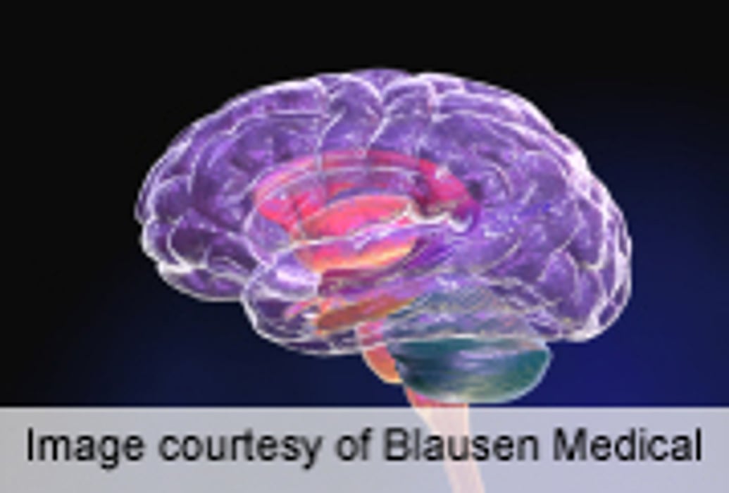 Brain Chemical Changes Identify Children With Autism