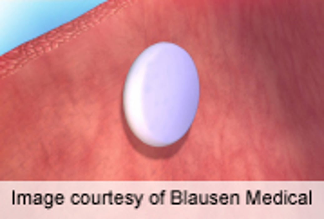 Melatonin Effective for Sleep in Patients Taking β-Blockers