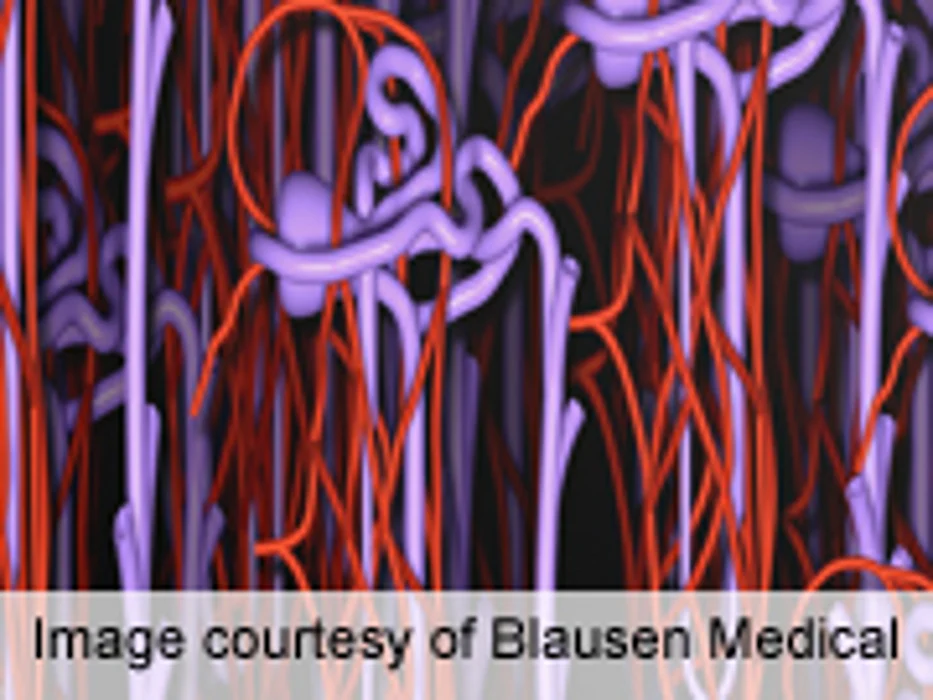 Transplant Procedure Creates 'Hybrid' Immune System to Combat Rejection