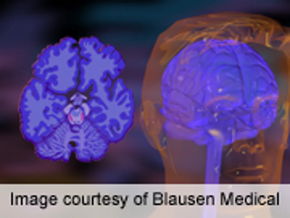 ADHD Diagnosis Rates Rose Sharply in Past Decade