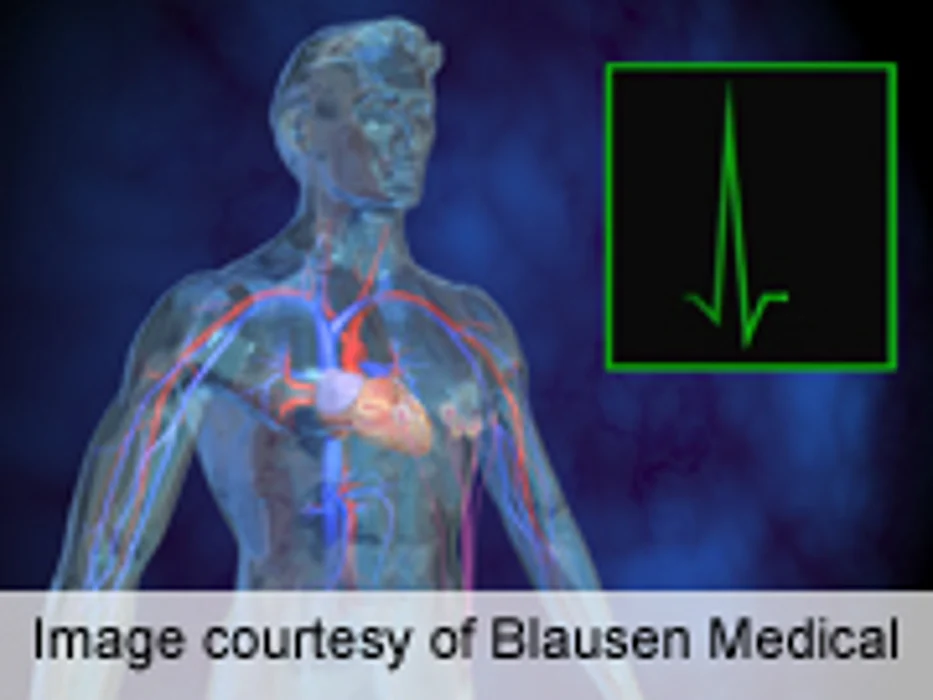 ECG Screening of Athletes in the U.S. Would Be Too Costly