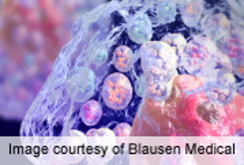 Drugs Previously Thought to Be Toxic May Stop Spread of Cancer
