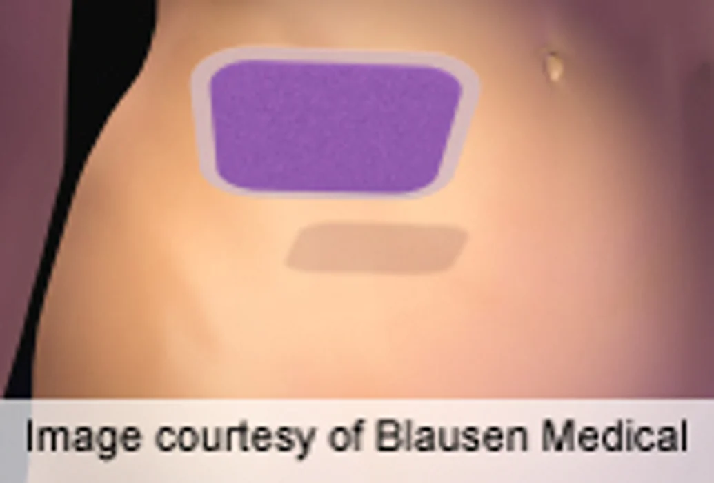 Wireless Skin Patch Developed to Transmit Medical Info