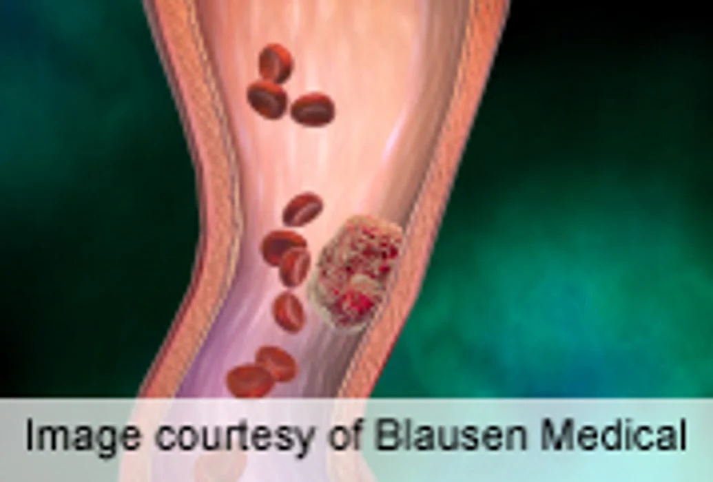 Study Clarifies LMWH Treatment for Cancer-Related DVT