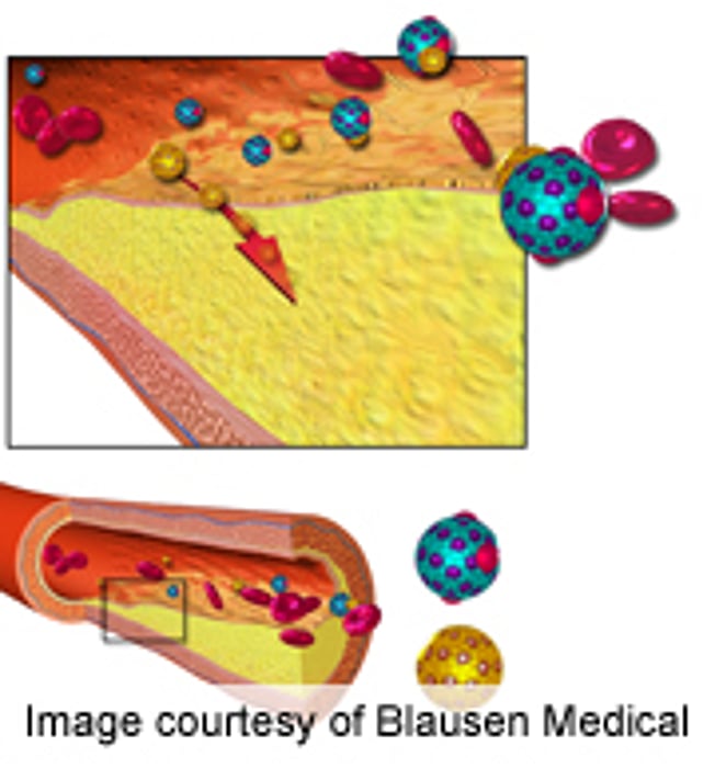 Fasting May Not Be Necessary for Cholesterol Tests