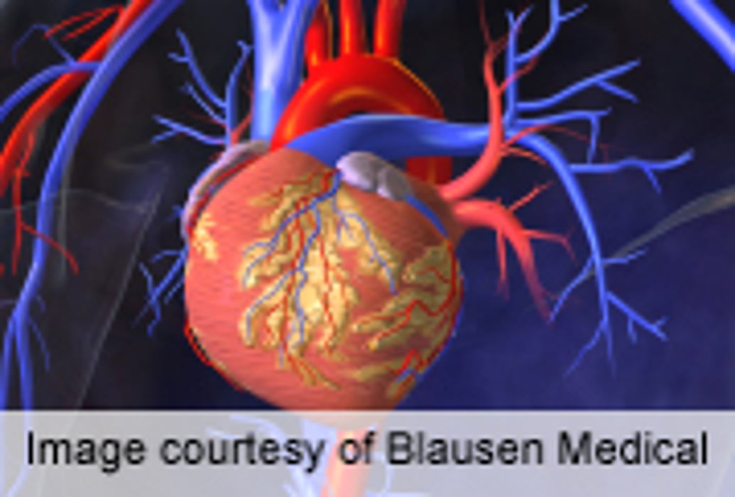 Visceral Fat Key Marker for Cardiometabolic Risk