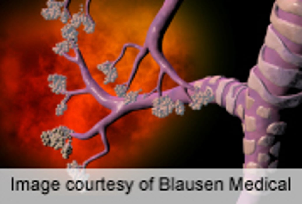 Respiratory Virus Patterns ID'd for Urban, Suburban Infants