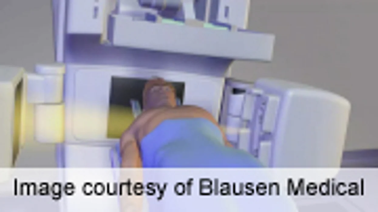 CT Scans Deliver More Radiation to Obese People: Study