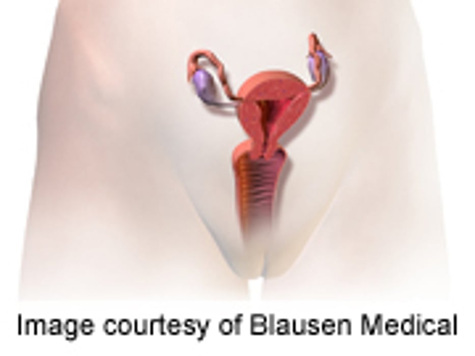 'Surgeon-Tailored' Mesh Repair Resolves Urinary Incontinence