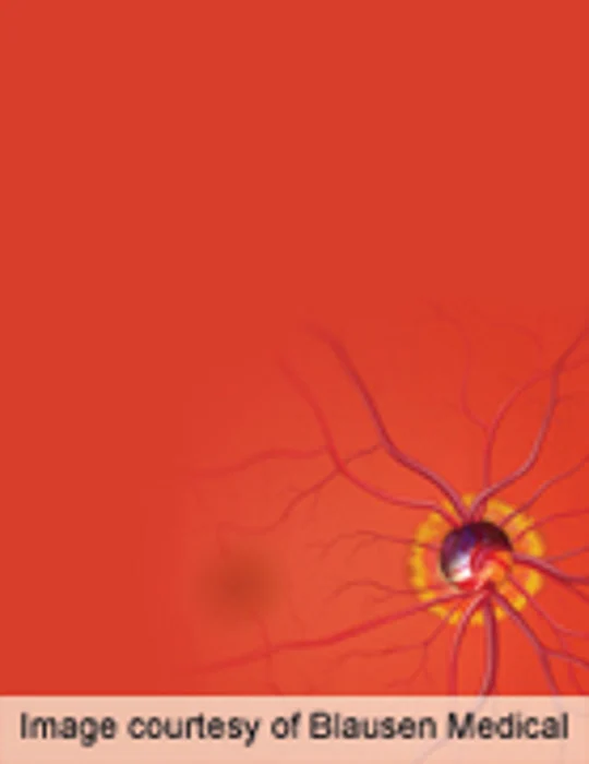 Retinal Prosthesis Allows Blind Patient to "Read"