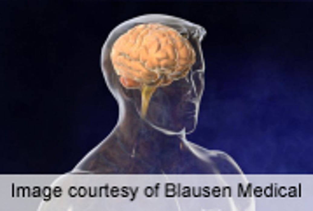 Exercise May Improve Cognition in Dementia