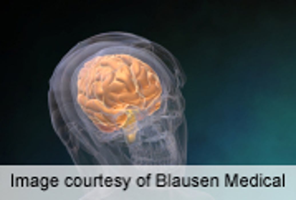Recent Increase Noted in High School Athlete Concussion Rates