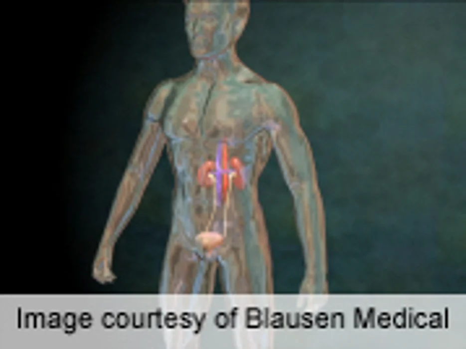 Nephron Sparing Surgery Has Excellent Lasting Outcomes