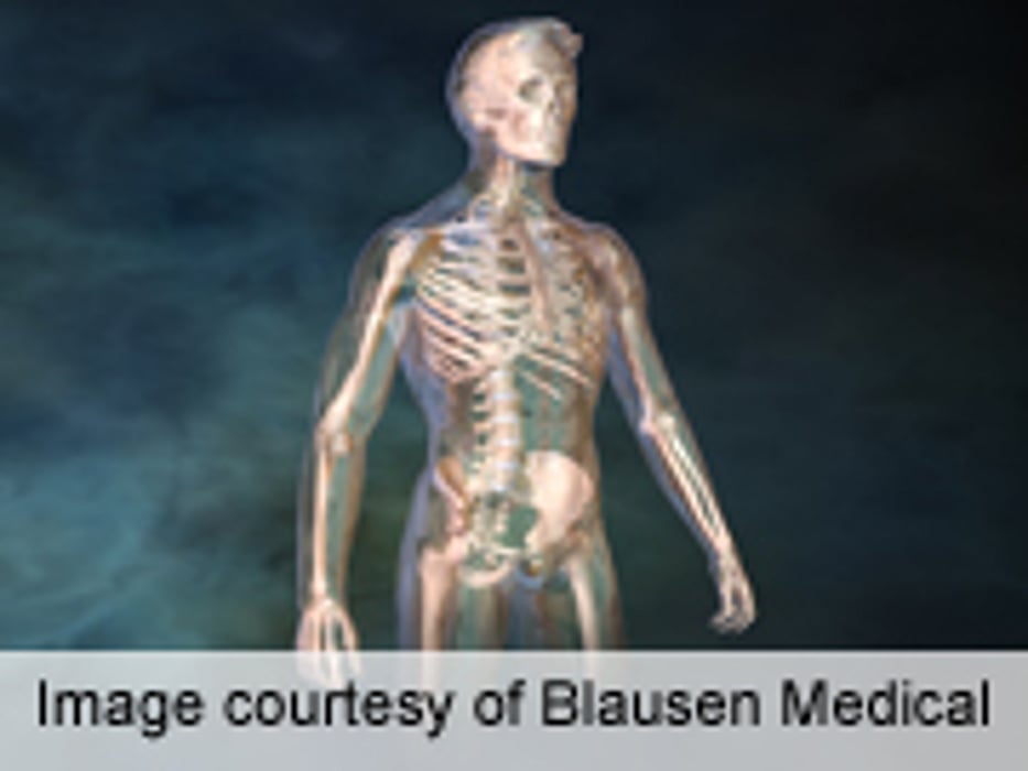 Denosumab Studied As Therapy for Giant-Cell Tumor of Bone