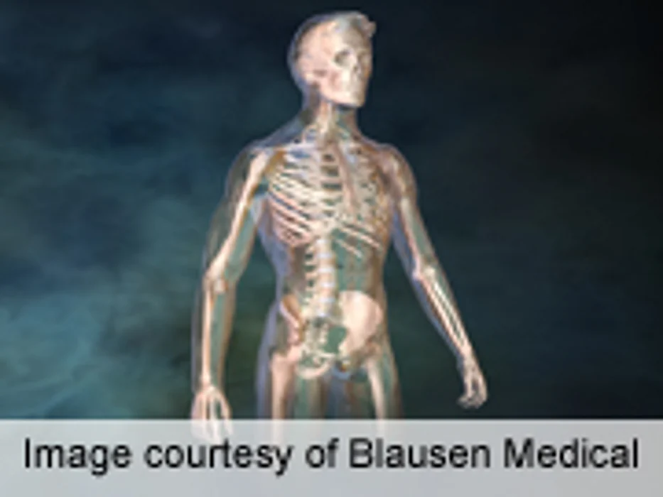 Men May Benefit From Osteoporosis Drug, Too: Study
