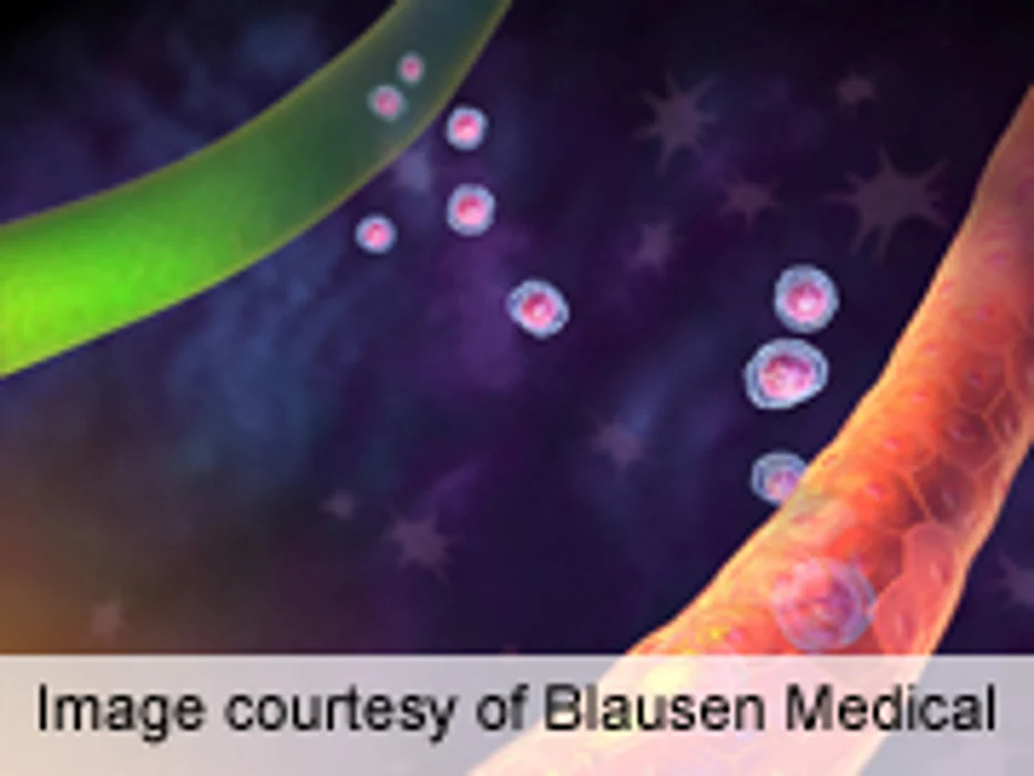 Lenalidomide Maintenance Beneficial in Multiple Myeloma