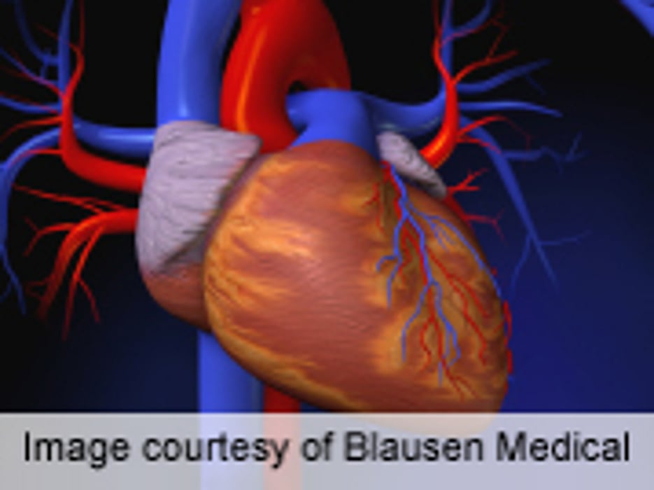 Mismatched Organ Size Tied to Worse Heart Transplant Outcome - Consumer Health News | HealthDay Mismatched Organ Size Tied to Worse Heart Transplant Outcome - Consumer Health News | HealthDay