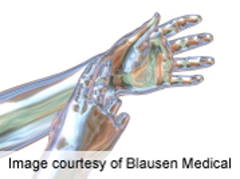 Gender, High DAS28-P Index Predictive of Pain in Early RA