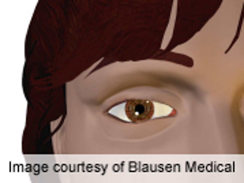 Eye Changes May Predict Heart Disease in Blacks With Diabetes
